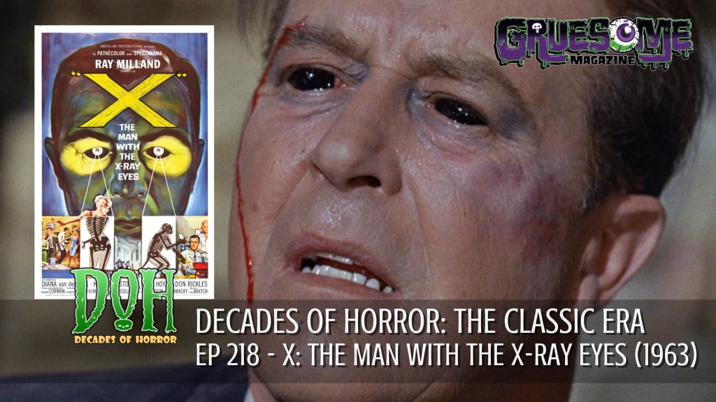 S01E218 Video Review - X: THE MAN WITH X-RAY EYES